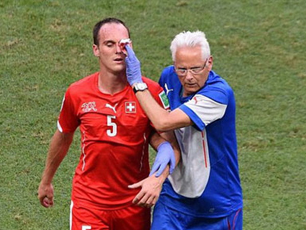 Cầu thủ Thụy Sĩ rách mặt, đổ máu sau pha cao chân của Giroud ảnh 1