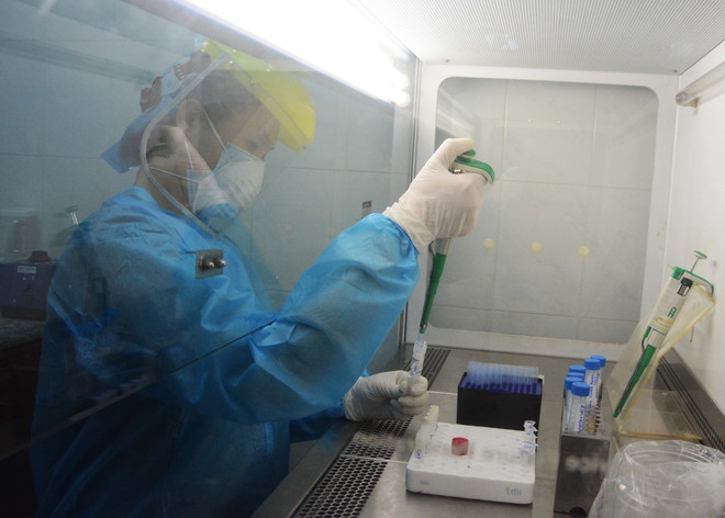 Thêm 1 trường hợp tái dương tính với virus SARS-CoV-2 ở TP.HCM ảnh 1