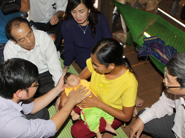 Cháu bé bị đầu nhỏ tại Đắk Lắk có thể do nhiều nguyên nhân ảnh 1