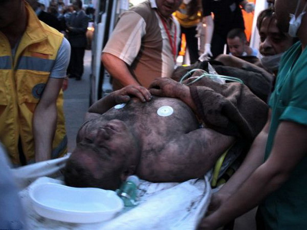 Ít nhất 166 người thiệt mạng do nổ mỏ than ở Thổ Nhĩ Kỳ ảnh 1