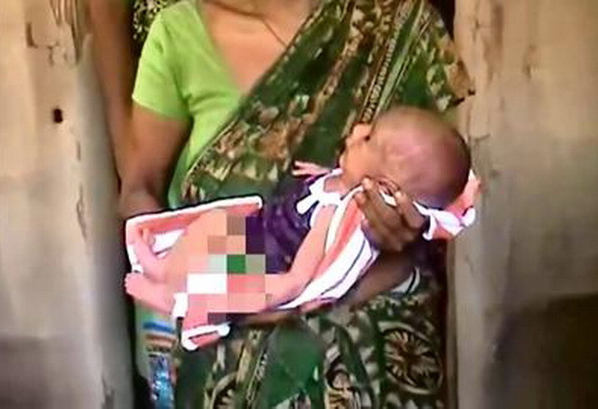 Bác sỹ phù thủy ép bé trai 2 ngày tuổi “biết đi” để chữa sốt ảnh 1