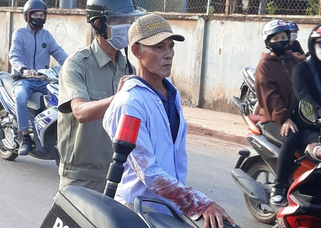 Ghen tuông, một người đàn ông tấn công khiến 2 người thương vong ảnh 1