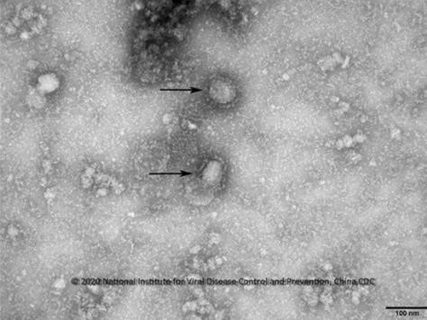 Virus corona mới, được cho là nguyên nhân gây ra dịch viêm phổi lạ tại Vũ Hán, Trung Quốc. (Ảnh: Yonhap/ TTXVN) Hướng dẫn Chẩn đoán và điều trị bệnh phổi do chủng virus Corona mới ảnh 1