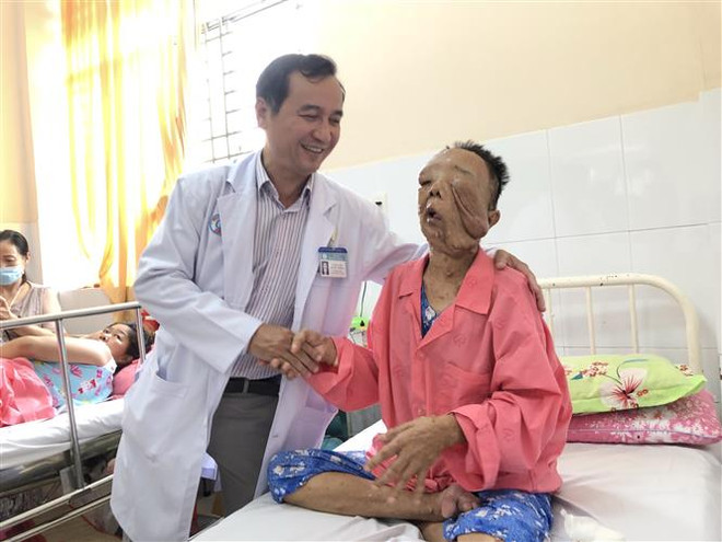 Phẫu thuật loại bỏ hai khối u thần kinh khổng lồ trên mặt nữ bệnh nhân ảnh 1