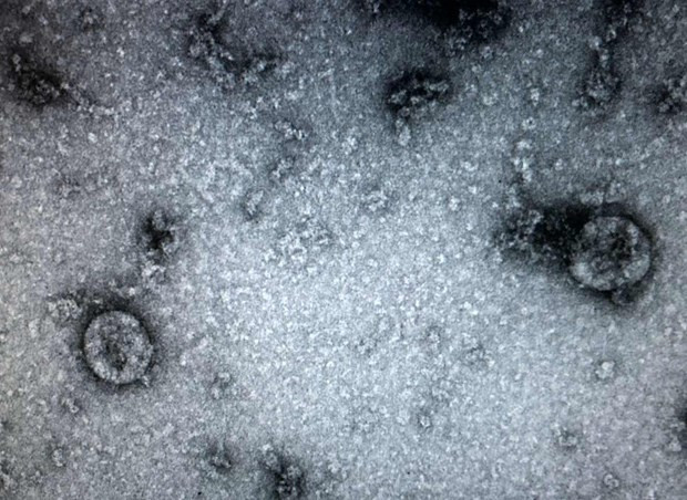 Virus corona chủng mới được Viện Vệ sinh dịch tễ trung ương nuôi cấy và phân lập thành công. (Ảnh: PV/Vietnam+) Bộ Y tế: Việt Nam đủ năng lực, sinh phẩm xét nghiệm dịch bệnh ảnh 1