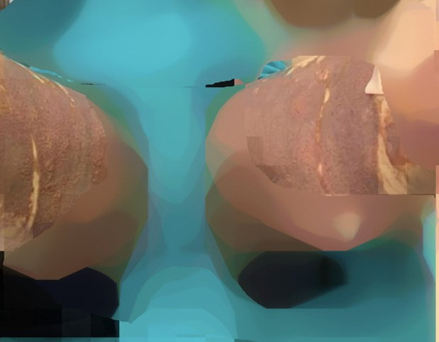 Phẫu thuật thẩm mỹ không phép: Chế tài xử phạt chưa đủ răn đe ảnh 1