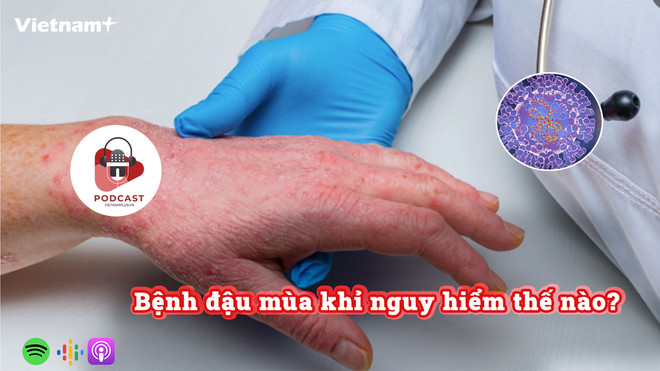 [Audio] Bệnh đậu mùa khỉ nguy hiểm thế nào? ảnh 1