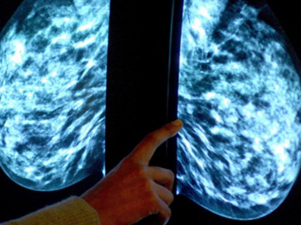 New Zealand công bố kế hoạch quốc gia về phòng chống ung thư ảnh 1