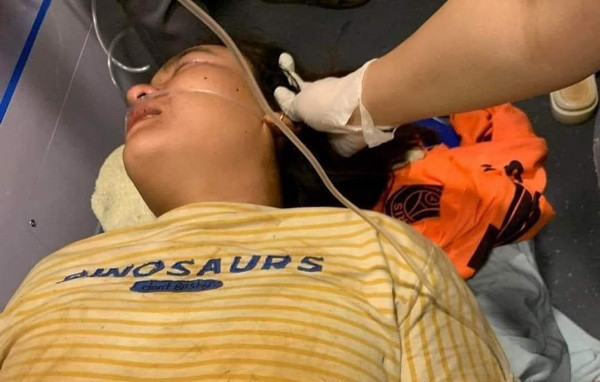 Bình Phước: Thu gom càphê dưới gốc cây lớn, cả gia đình bị sét đánh ảnh 1