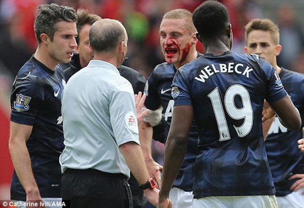 Tin 12/5: Vidic đổ máu ngày chia tay, Cole rời “Tam sư” ảnh 1