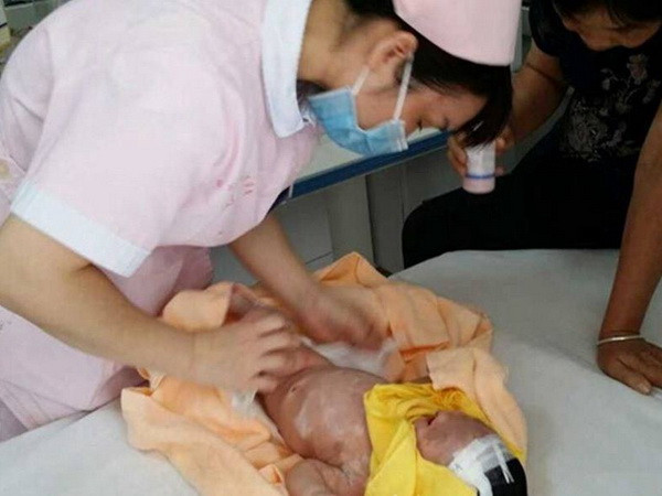 Trung Quốc: Bắt giữ gia đình bỏ rơi bé sơ sinh bị sứt môi ảnh 1