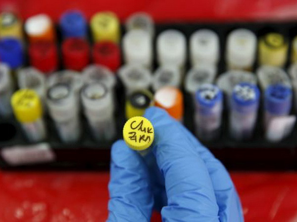 Cuba thông báo chẩn đoán trường hợp nhiễm virus Zika thứ 2 ảnh 1