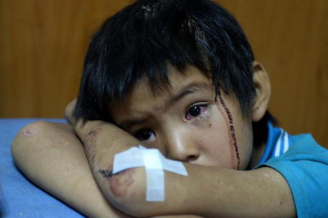 Cận cảnh đau thương sau vụ động đất 6,5 độ Richter ở Trung Quốc ảnh 1