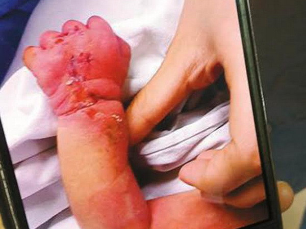 Đau lòng cảnh người mẹ tâm thần cắn nát tay con trai vừa sinh ảnh 1