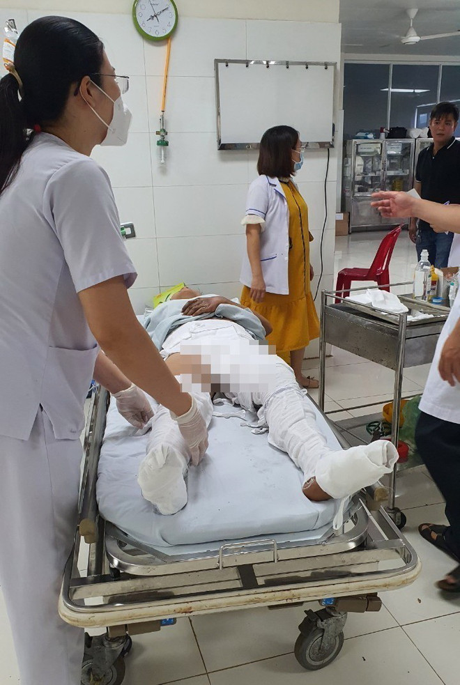 Nữ công nhân bị bỏng nặng do điện giật tại công trình xây dựng ảnh 2