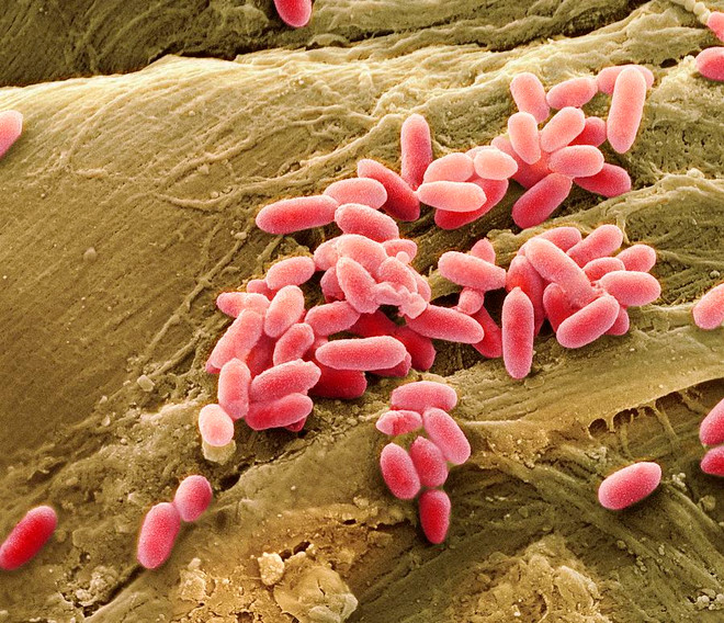 Lý giải nguyên nhân một số người bị các vết thương rất lâu lành ảnh 1