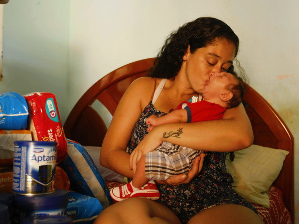 Brazil: WHO quá thận trọng về liên quan giữa Zika với bệnh đầu nhỏ ảnh 1