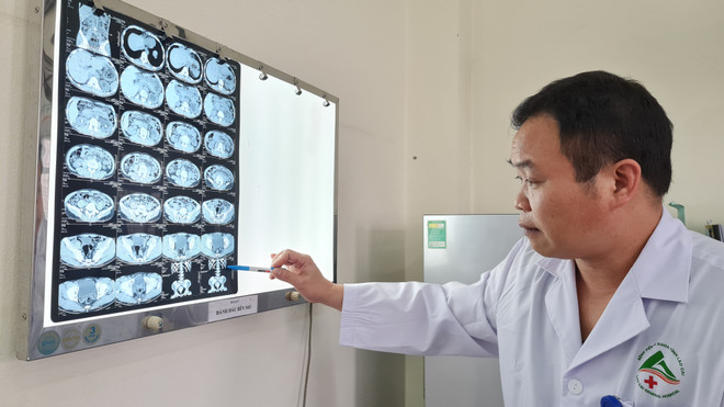 Bác sỹ Nguyễn Văn Hải chính là một trong những người tiên phong đưa kỹ thuật mổ nội soi về triển khai rộng rãi tại Lào Cai. (Ảnh: Hương Thu/TTXVN) Ngày Thầy thuốc Việt Nam: Người thầy thuốc sáng y đức, giỏi y thuật ảnh 1