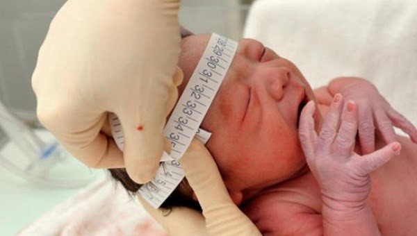 Thông tin chính thức về vụ bác sỹ mổ trúng đầu trẻ sơ sinh ảnh 1