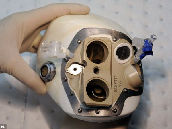 Bệnh nhân đầu tiên trên thế giới lắp tim nhân tạo qua đời ảnh 1