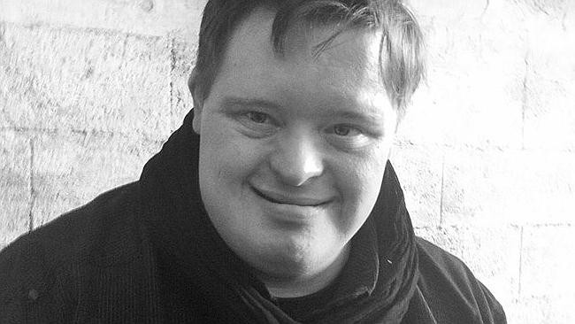 Một bệnh nhân Down nhận được tới 30.000 thiệp mừng sinh nhật ảnh 1