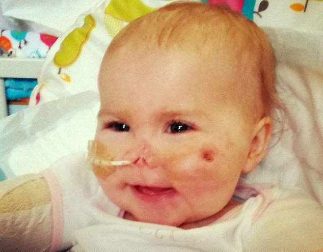 Cảm động nghị lực của bé gái mất tứ chi vì bệnh viêm màng não ảnh 1