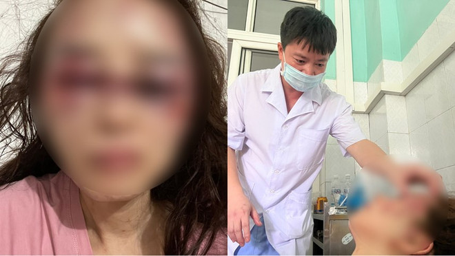 Thanh Hóa: Tạm giam cán bộ quản lý thị trường đánh đập dã man bạn gái ảnh 1