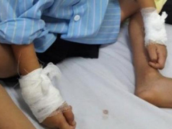 Lại một ca mổ nhầm tay cho bệnh nhi 6 tuổi ở Nghệ An ảnh 1