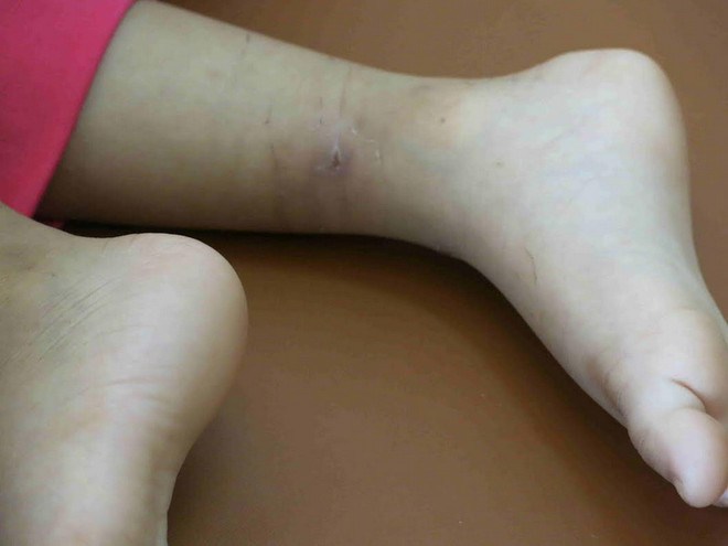 [Photo] Nỗi đau xót lòng vụ bé gái bị bạo hành ở Bình Dương ảnh 4