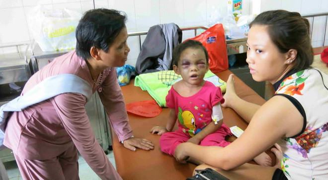 [Photo] Nỗi đau xót lòng vụ bé gái bị bạo hành ở Bình Dương ảnh 9