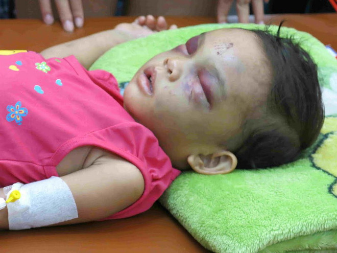 [Photo] Nỗi đau xót lòng vụ bé gái bị bạo hành ở Bình Dương ảnh 11