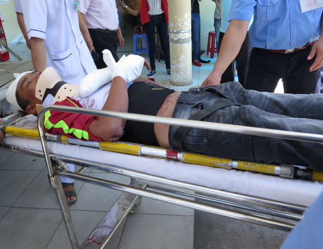 [Photo] Cấp cứu nạn nhân vụ lật xe nghiêm trọng trên đèo Khánh Lê ảnh 3