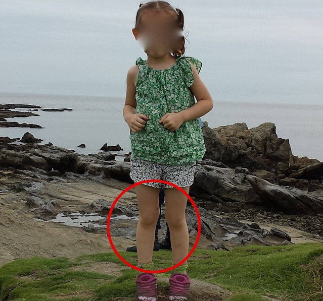 Tiết lộ sốc từ cha của cô bé trong bức ảnh xuất hiện “đôi chân ma” ảnh 1