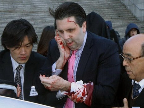 Đại sứ Mỹ tại Hàn Quốc bị tấn công bằng dao khi chuẩn bị phát biểu ảnh 1