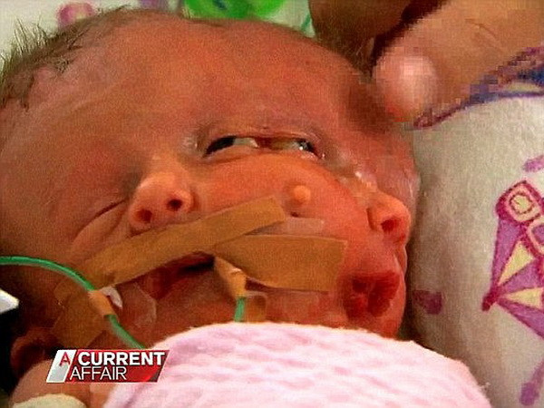 Nhiều kỷ vật vô giá của cặp song sinh đặc biệt bị phá hoại ảnh 1