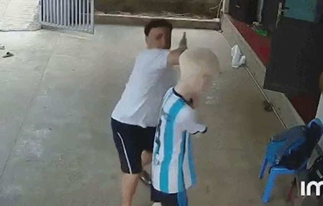 Hà Nội: Điều tra, xác minh vụ việc một cháu bé bị hành hung ảnh 1