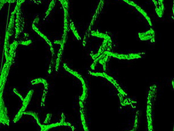 Cải thiện tình trạng lão hóa bằng liệu pháp "ma cà rồng"? ảnh 3