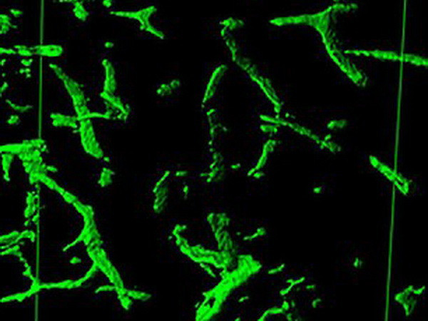 Cải thiện tình trạng lão hóa bằng liệu pháp "ma cà rồng"? ảnh 4