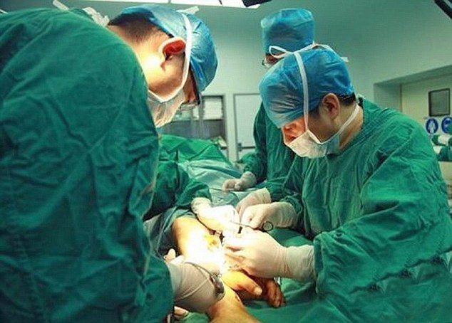 Trung Quốc: Phẫu thuật ghép bàn tay đứt lìa vào chân để cứu tay ảnh 2