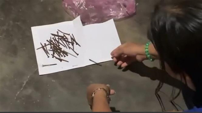 Quảng Ngãi phản hồi thông tin về đinh sắt rút ra từ cơ thể một phụ nữ ảnh 1