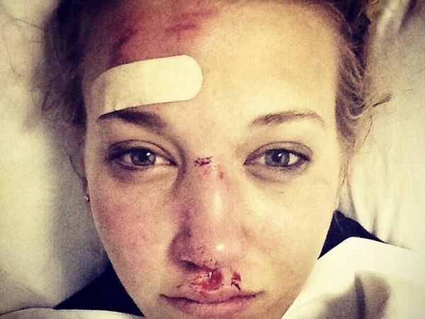 Olympic Sochi: Nữ vận động viên 18 tuổi người Anh bất tỉnh ảnh 1