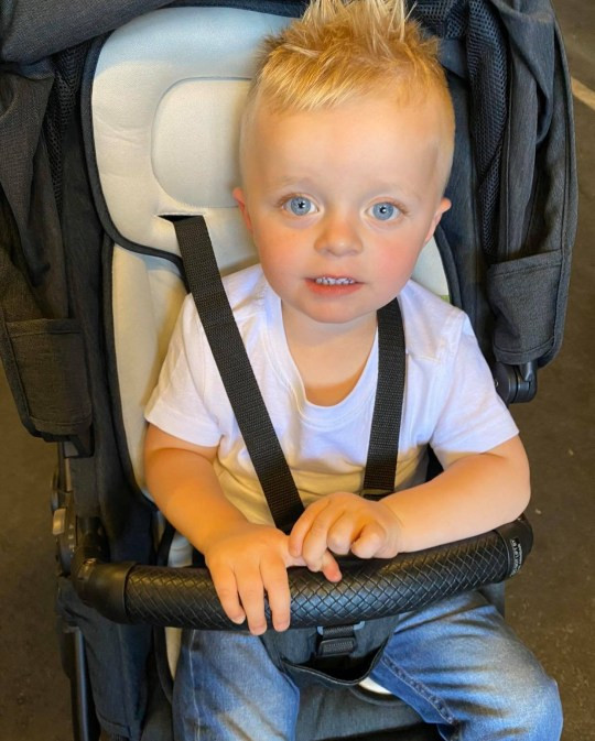 Cậu bé mang làn da nhem nhuốc vì nhầm thuốc nhuộm da với xà phòng ảnh 2