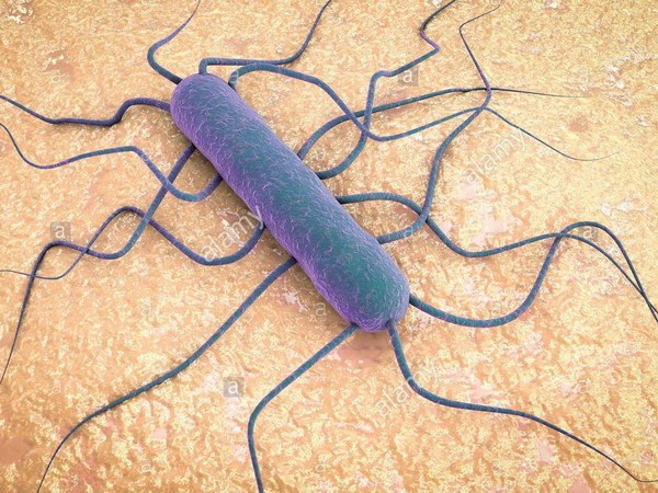 Bộ Y tế Namibia phát hiện ca nhiễm vi khuẩn Listeria đầu tiên ảnh 1