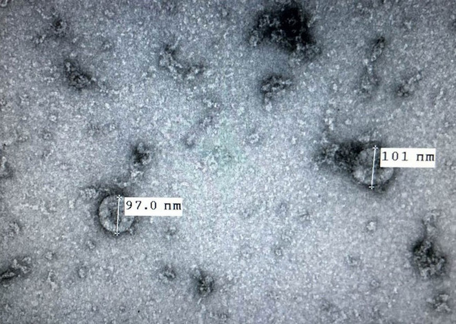 Việt Nam làm chủ nhiều kỹ thuật y học ngang tầm thế giới ảnh 3