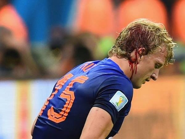 Dirk Kuyt chảy máu ròng ròng vẫn chiến với Brazil tới cuối trận ảnh 1