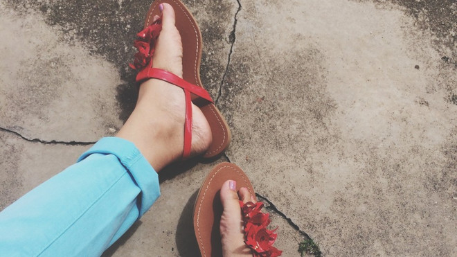 Dép xỏ ngón, giày thể thao, sandals đế bằng nguy hiểm cỡ nào? ảnh 1