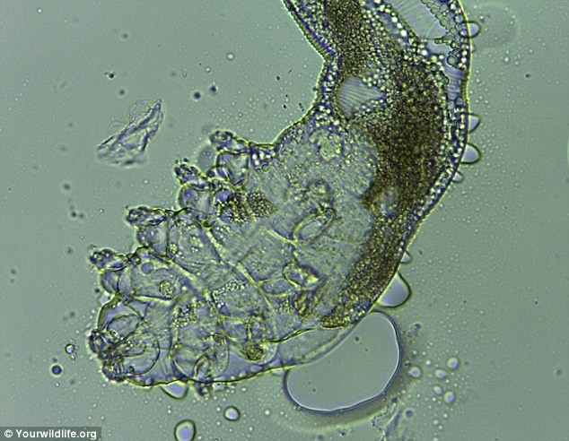 Vẻ ngoài đáng sợ của loài ký sinh trùng trên da mặt con người ảnh 2