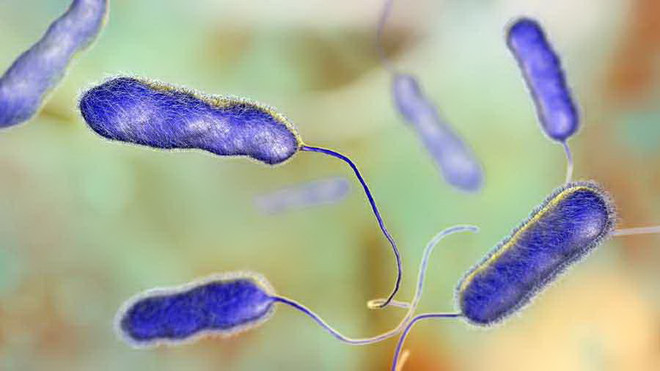 Argentina ghi nhận 5 trường hợp tử vong do nhiễm vi khuẩn Legionella ảnh 1