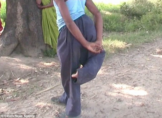 Chàng trai bốn chân bị hắt hủi khao khát trở thành thầy giáo ảnh 2