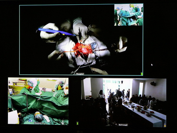 Hà Nội thực hiện thành công ca ghép thận đầu tiên ảnh 1